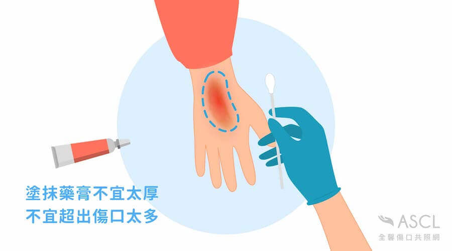 使用抗生素藥膏