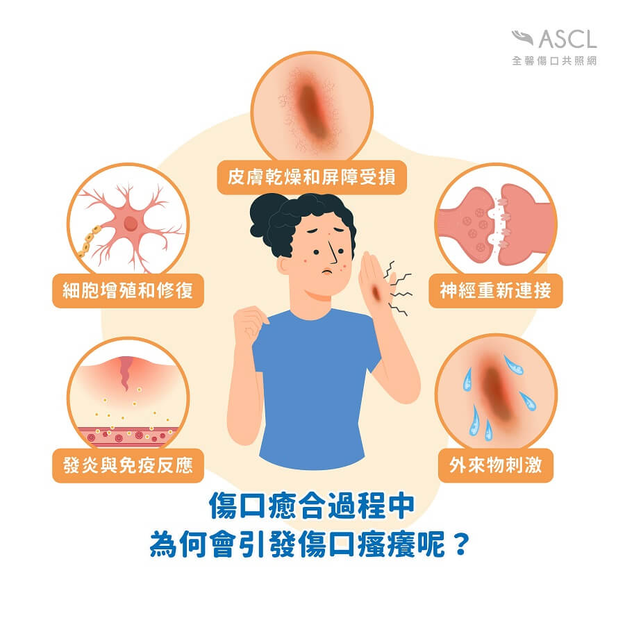 傷口為什麼會癢