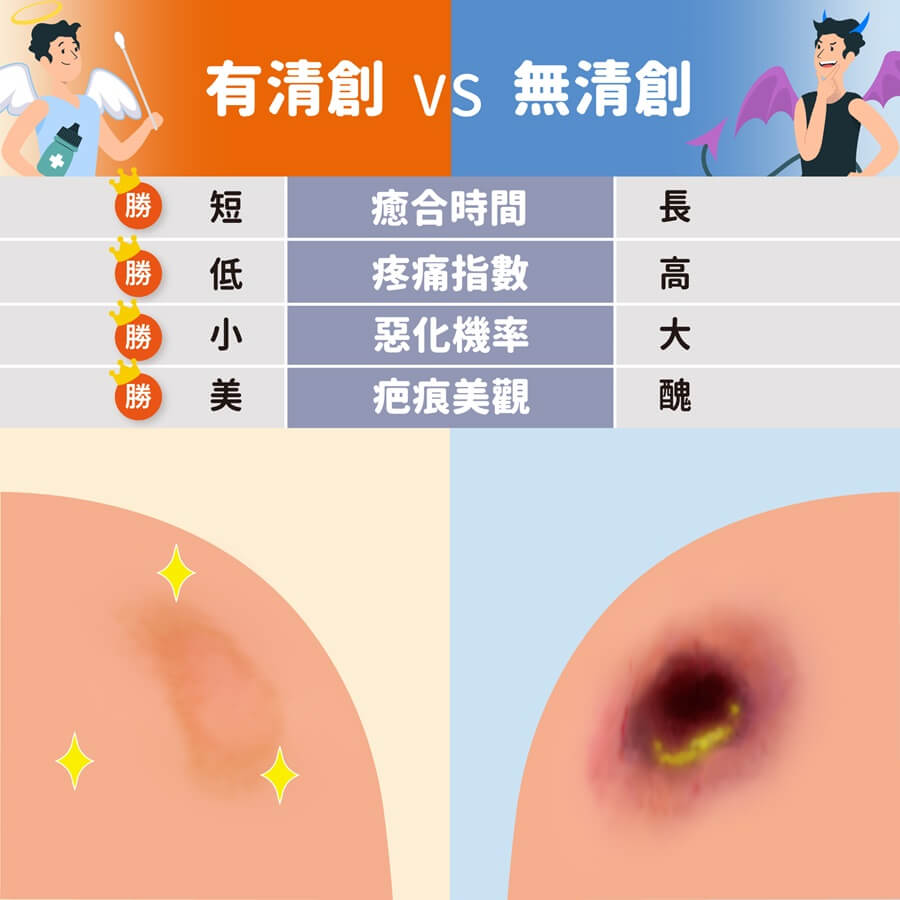 清創或不清創