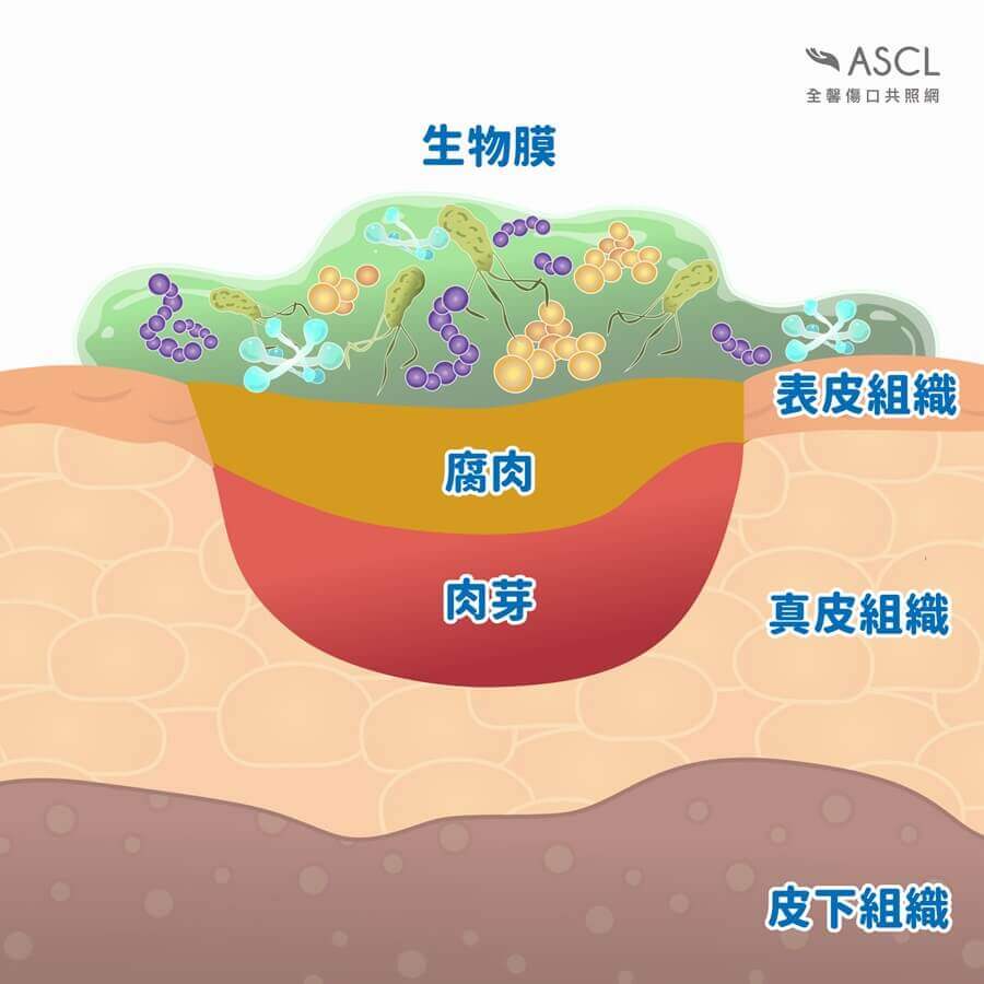 傷口生物膜 傷口生物膜