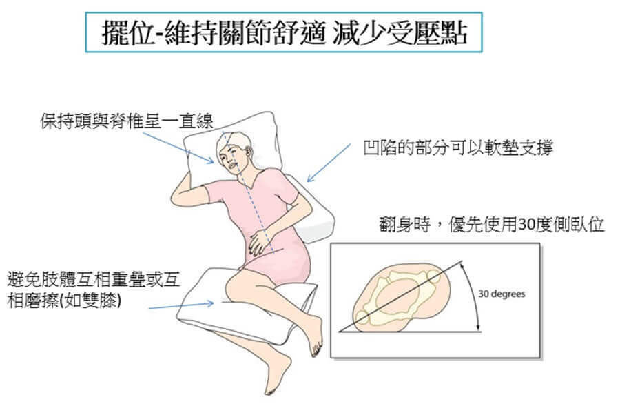 預防壓瘡-擺位