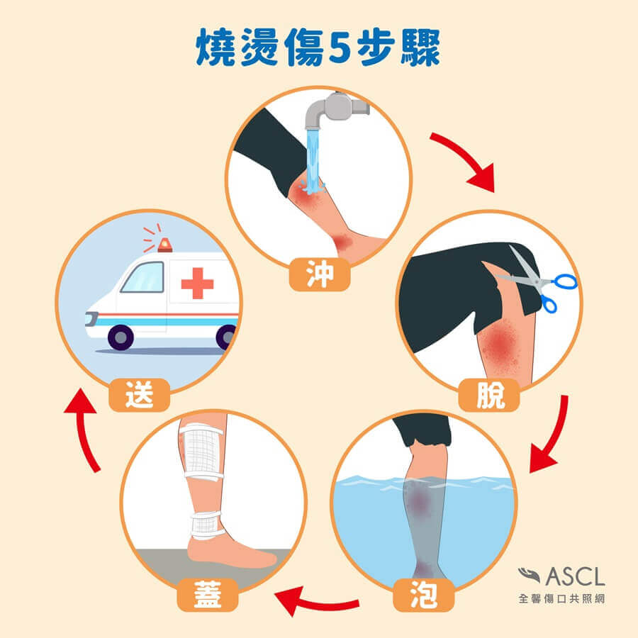 沖脫泡蓋送 沖脫泡蓋送