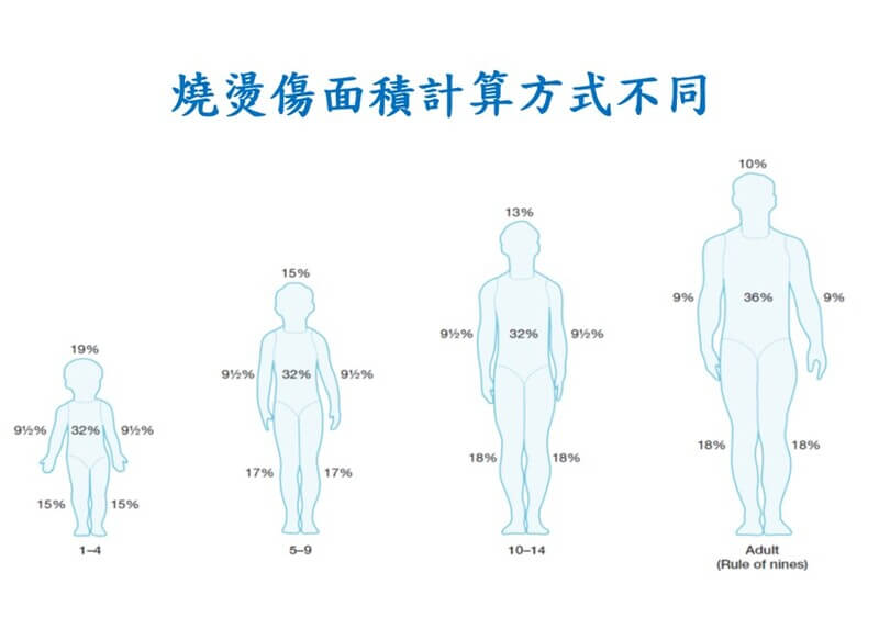 燒燙傷面積計算