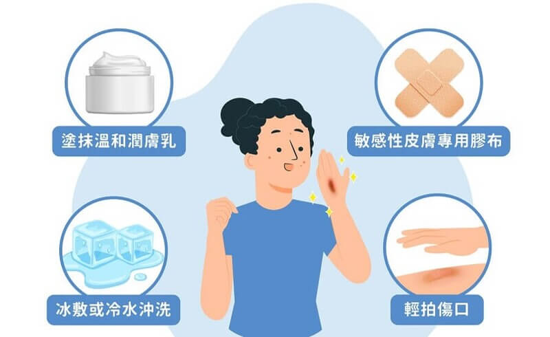 燒燙傷會癢
