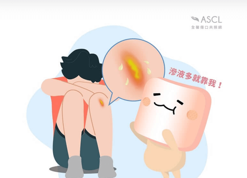 泡棉敷料 泡棉敷料