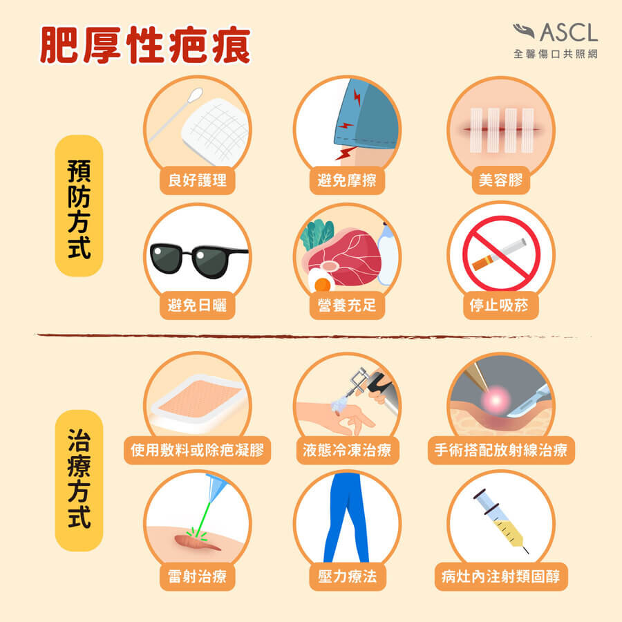 肥厚性疤痕預防與治療方式