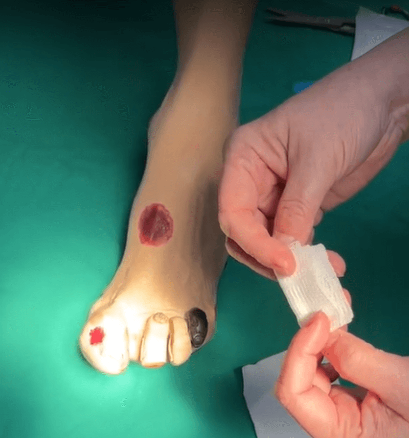 腳趾傷口包紮1
