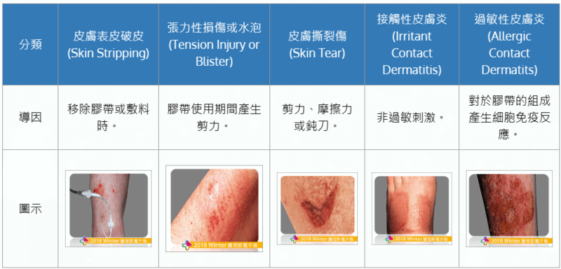 醫療黏性產品相關皮膚損傷 醫療黏性產品相關皮膚損傷